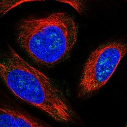 KLHDC4 Antibody, Novus Biologicals 25 &mu;L; Unlabeled:Antibodies, Polyclonal